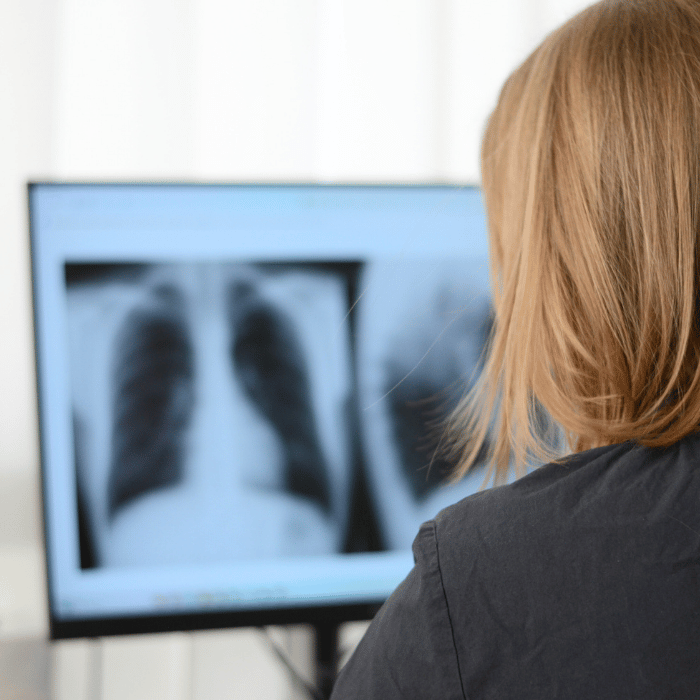 Sabine Entner Lungenfachärztin